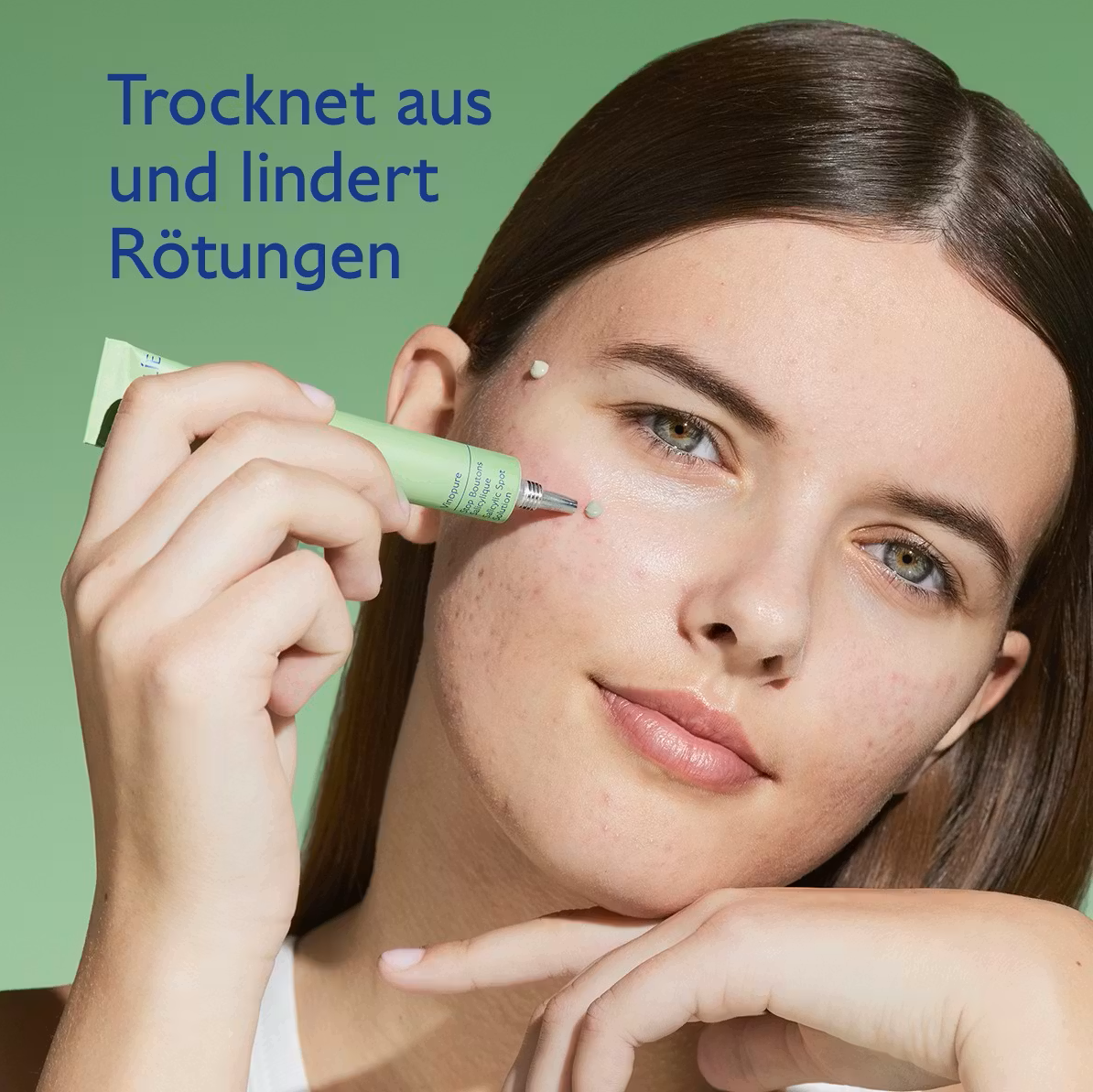 Vinopure Pickel Stopp  mit Salicylsäure 15ml