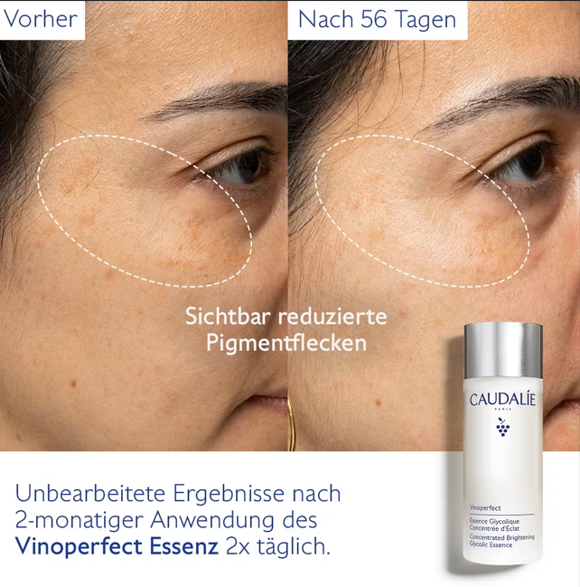 Vinoperfect Essenz mit Glykolsäure 100ml Vinoperfect Essenz mit Glykolsäure 100ml